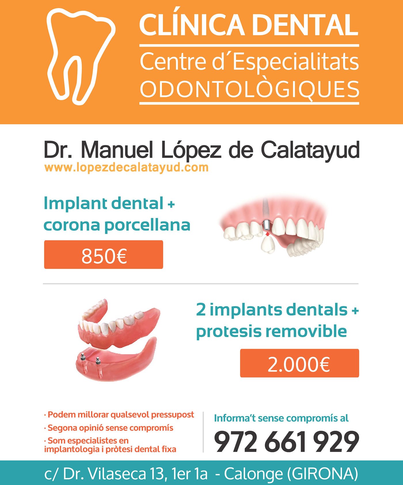 Promoción Implantes | Dr. Manuel López de Calatayud