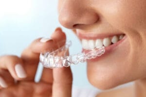 Dr. Manuel López de Calatyud - Blog - Ortodoncia invisible