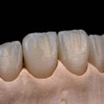 Dr. Manuel López de Calatayud - Prótesis de Grafeno