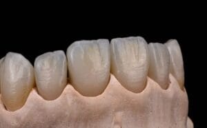 Dr. Manuel López de Calatayud - Prótesis de Grafeno