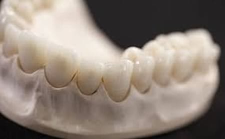 Dr. Manuel López de Calatayud - Prótesis de Grafeno