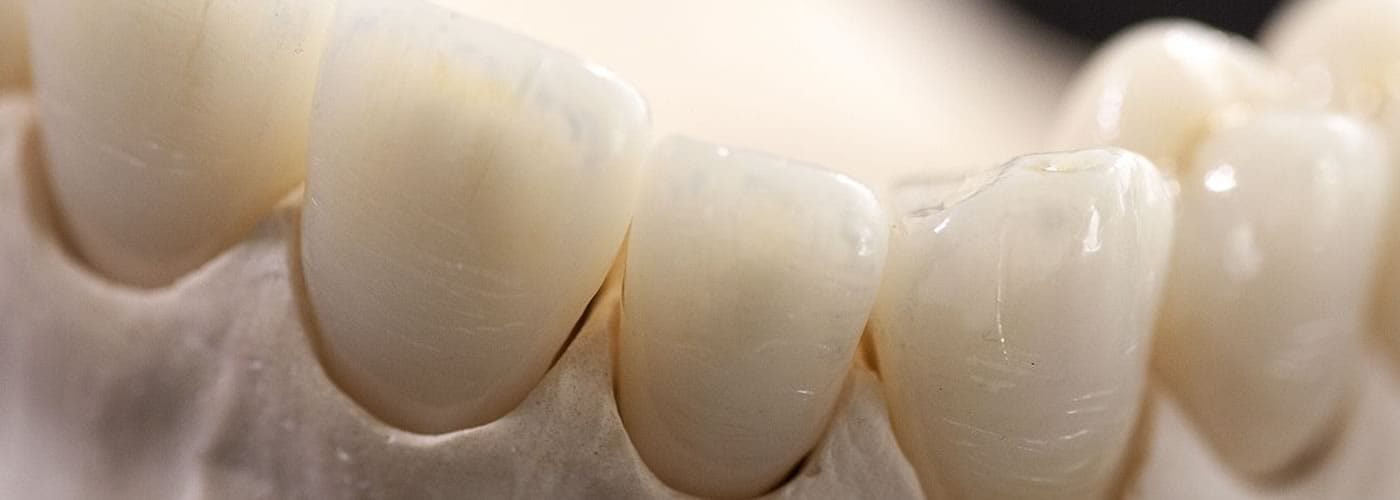 Prótesis de Grafeno | Dr. Manuel López de Calatayud